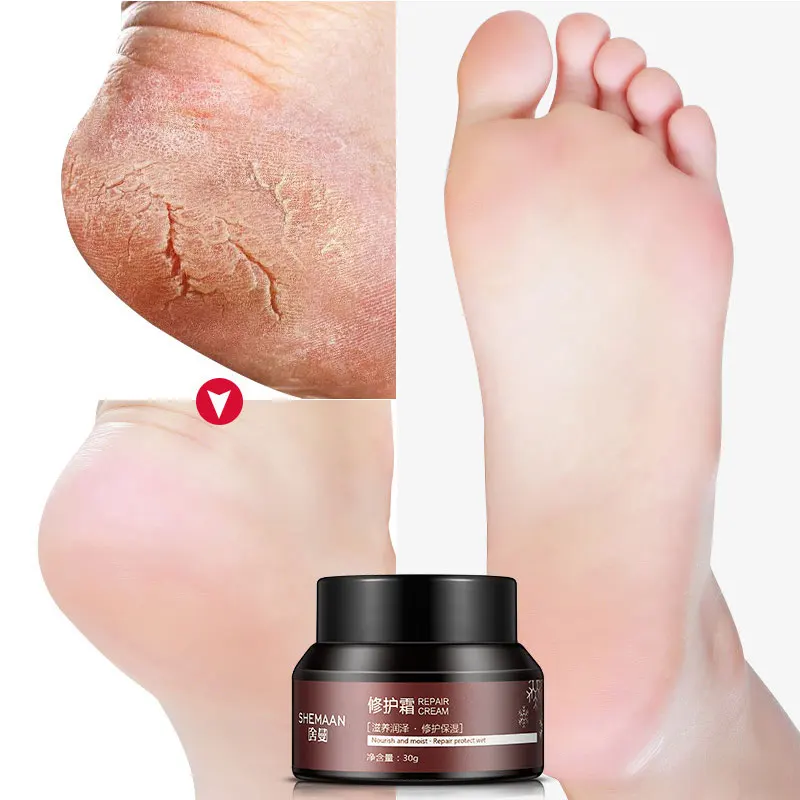 SHEMAAN крем для ног анти сухую потрескавшуюся ноги анти-обморожения глубоко увлажняющий восстанавливающие кремы сухую кожу увлажняющие средства для ухода за ногами