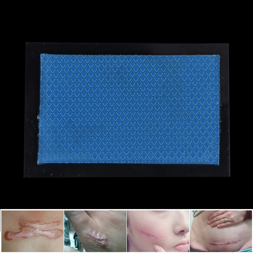 Силикон удаления патч Многоразовые Acne гель шрам терапия кремния патч удалить "Burn Простыни восстановления кожи 7.5*4.5 см