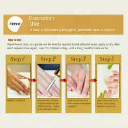 Травяные грибковые лечение эфирные масла для рук и ног отбеливание ног удаление грибка инфекции средства ухода за кожей стоп гель