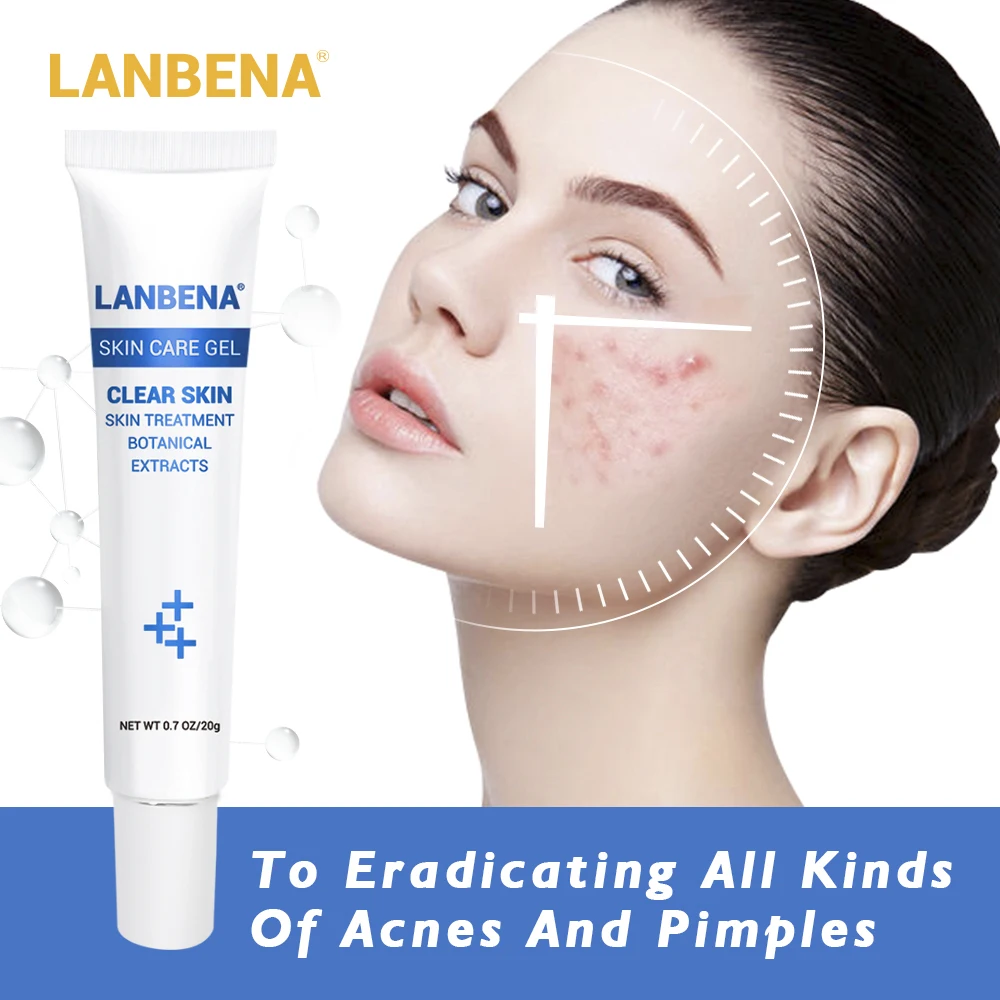 LANBENA Acne Treatment Gel Acne Cleaning Cream Blackhead Remover Acne Spots Face Acne Scars Skin Care Repair Comedone Pimple