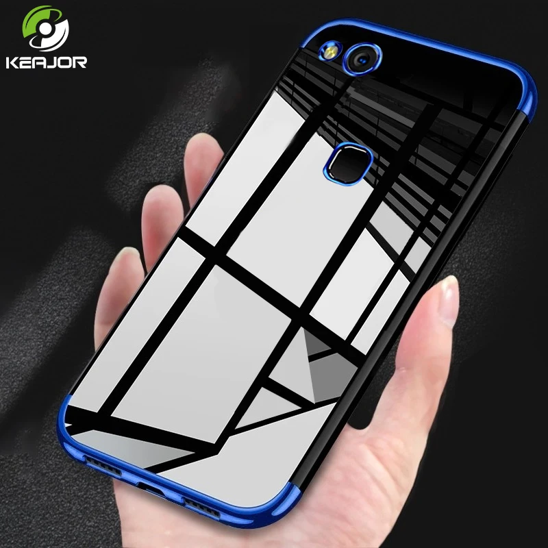 

Keajor Soft Case For Huawei P10 Lite Case TPU Silicone Plating Cover Transparent Clear Luxury Case For Huawei P 10 Lite Funda
