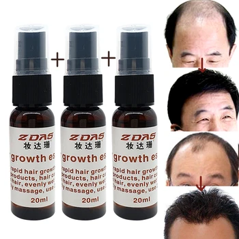 

Anti-hair loss Products additional germinal dense hair liquid medicine fast hair growth agent seborrheic essential serum 20ml 3