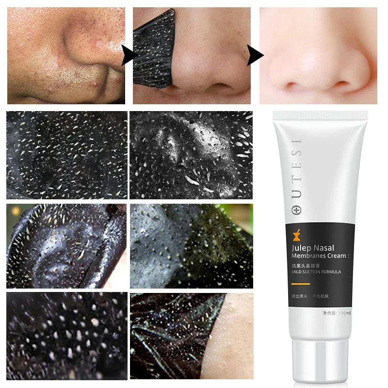 

100ml Nose Blackhead Remover Face Black Mask Deep Cleansing Strip Black Head Remover Acne Nose Mask Facial Skin Care