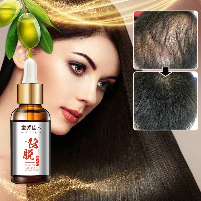 

Hot 30ml Vitamins A and E Hair Growth Development Essence Anti-hair Loss Hair Care Deep Nourishment Hair Conditioner New TSLM1