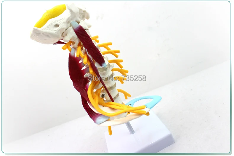 After Cervical Vertebra, Carotid Artery, Occipital, Intervertebral Disc And Nerve Model,Cervical Vertebra Model After Cervical Vertebra, Carotid Artery, Occipital, Intervertebral Disc And Nerve Model,Cervical Vertebra Model