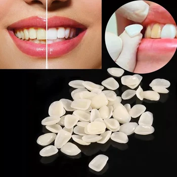 

100Pcs Provisionals Ultra-Thin Dental Temporary Crown Porcelain Materials Anterior Teeth Molar Tooth Patch Resin Teeth Veneers