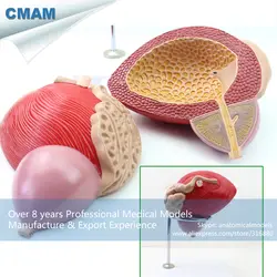 12428 cmam-urology08 Пластик мужской мочевой пузырь модель с простаты-2 части, Медицинские товары образования анатомические модели