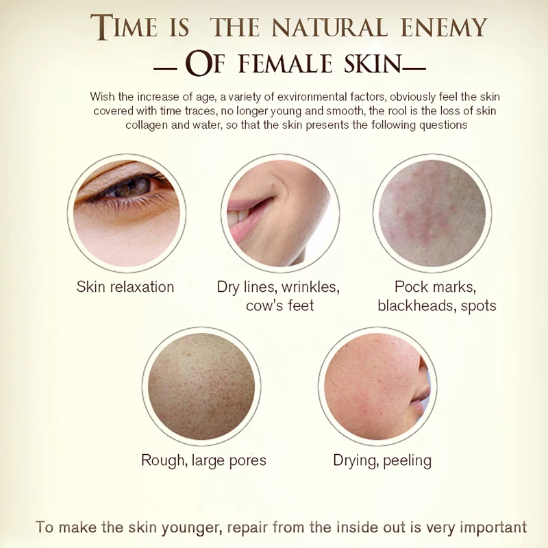 Face Moisturizers, Moisturizing Cream For Oily Skin Anti-Freckle Cream Strong Whitening Horse Oil Facial Cream Dark Spot  LAIKOU