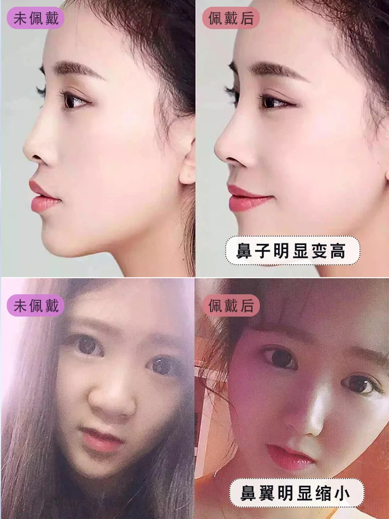 Beauty nose artifact nose bridge elevator female nose clip augmentation nose pad stiffener nose warping correction