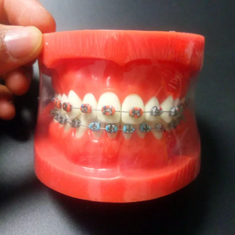 Orthodontic Dental Typodont Teeth Model with Fully Metal Bracket High Quality Dental Orthodontic Model With Teeth Brackets цена Orthodontic Dental Typodont Teeth Model with Fully Metal Bracket High Quality Dental Orthodontic Model With Teeth Brackets цены онлайн