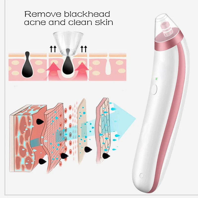 Jual Laikou Komedo Vacuum Listrik Pori Cleaner Jerawat Komedo Remover Pori Ekstraksi Vakum Hisap Wajah Kulit Perawatan Alat Pergi Jerawat