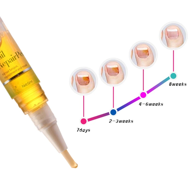 1 шт. 3 мл ручка для лечения грибков ногтей анти грибковая инфекция биологический Восстанавливающий раствор питательное масло восстанавливает здоровые ногти