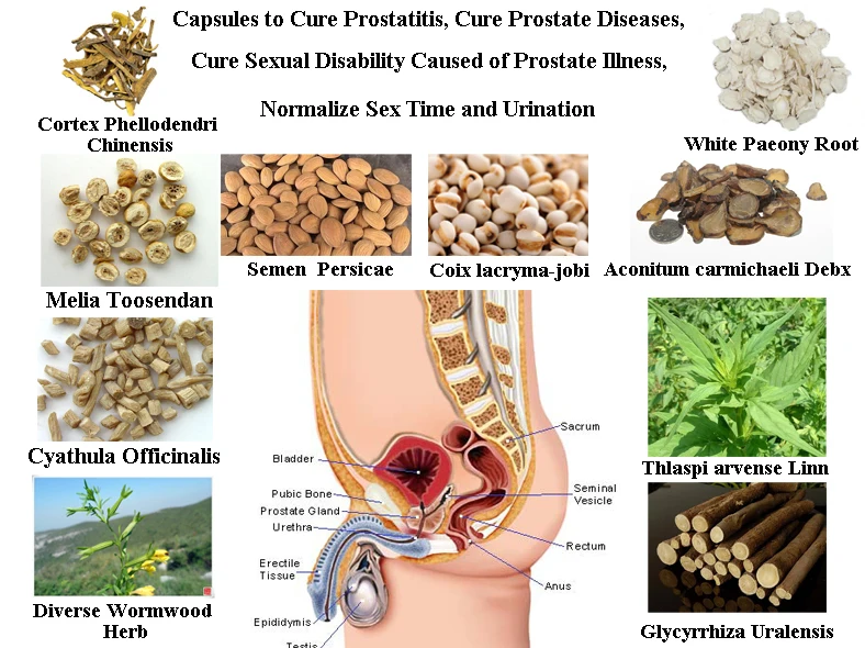 como solucionar el problema de la prostata como solucionar el problema de la prostata