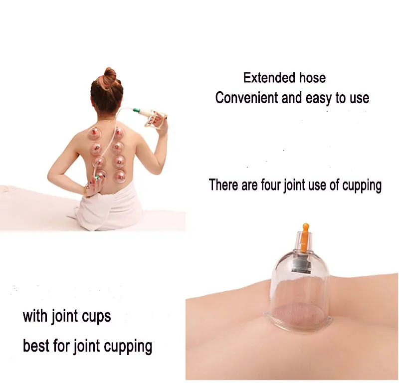 cupping (6)