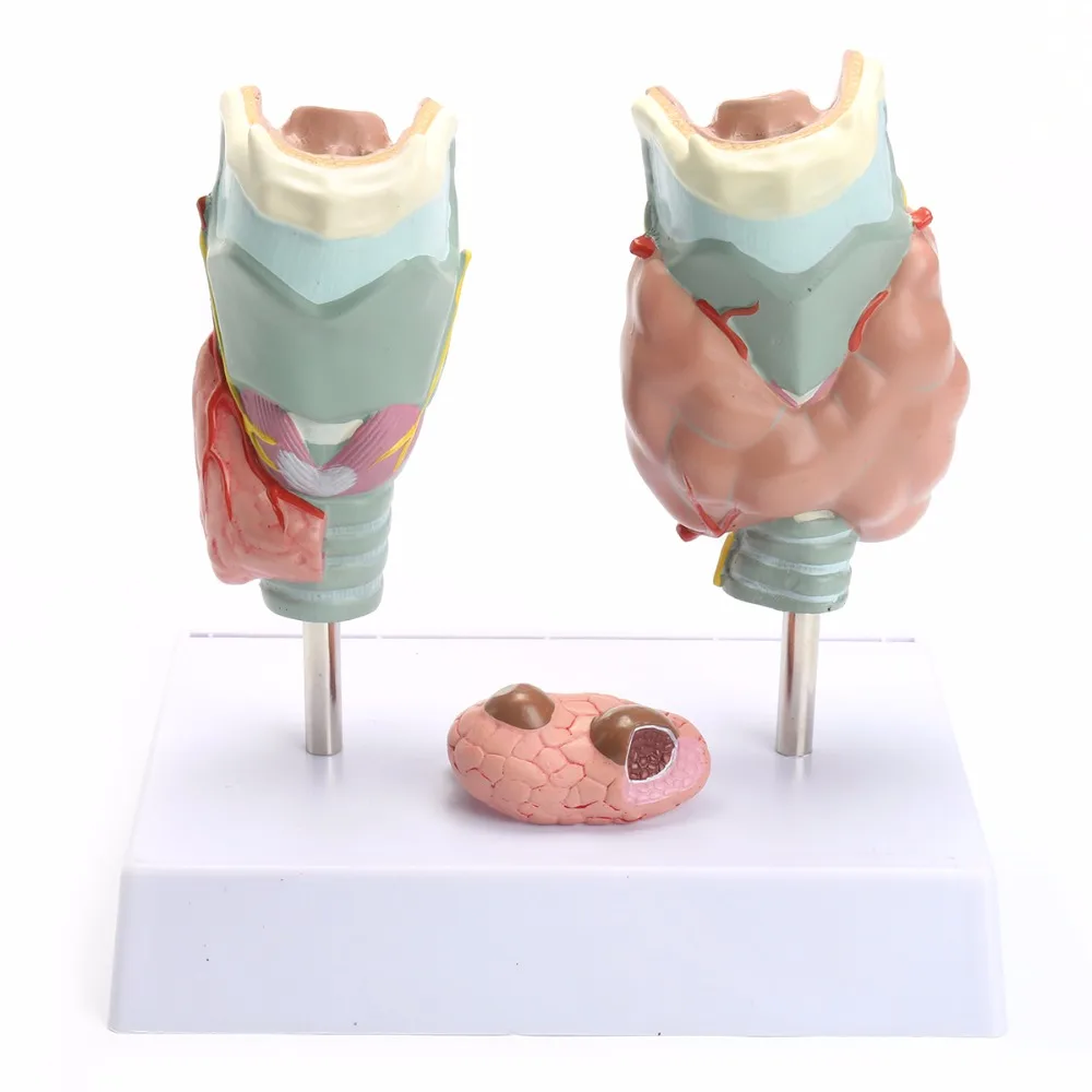 Human Anatomical Thyroid Gland Pathology Anatomy Teaching Model High