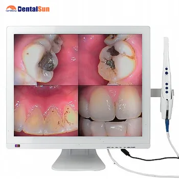 

CE ISO FDA Approved Intraoral Camera self contained 17inch LED Monitor