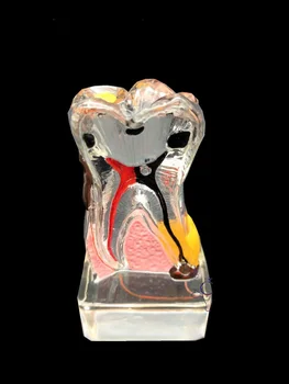 

Tooth Modle For periodontal disease/ 4 Times periodontal disease Teeth Modle