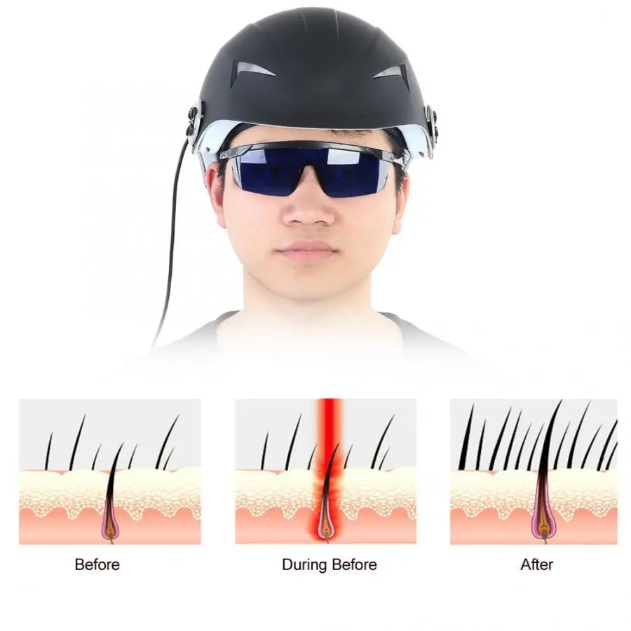 Лазерная терапия волос Regrowth шлем-приспособление 45 диодов Лазерная Обработка от выпадения волос способствует росту волос Лазерная шапочка