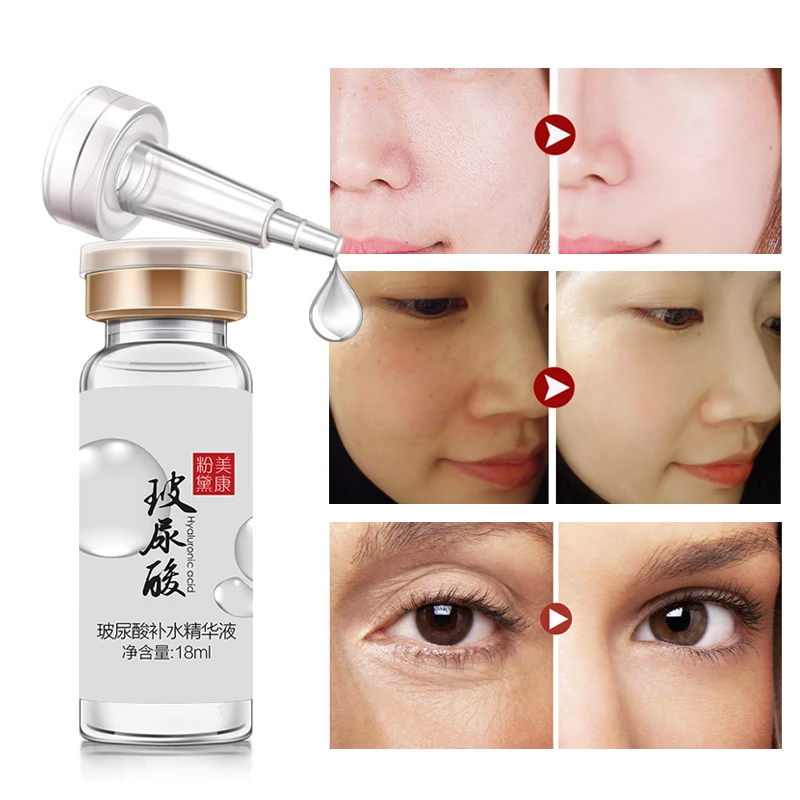 MEIKING Hyaluronic Acid Serum for Skin Anti-Aging Essence Hydration Moisture Non-greasy whitening face cream remove dark spots MEIKING Hyaluronic Acid Serum for Skin Anti-Aging Essence Hydration Moisture Non-greasy whitening face cream remove dark spots