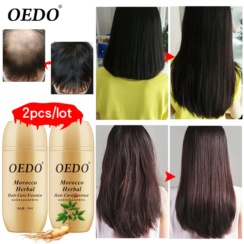 

Ginseng Moroccan Hair Essential Oil Rapid Growth Essential Oil Repair Damaged Hair Effective Treatment Hair Loss Improve Dryness