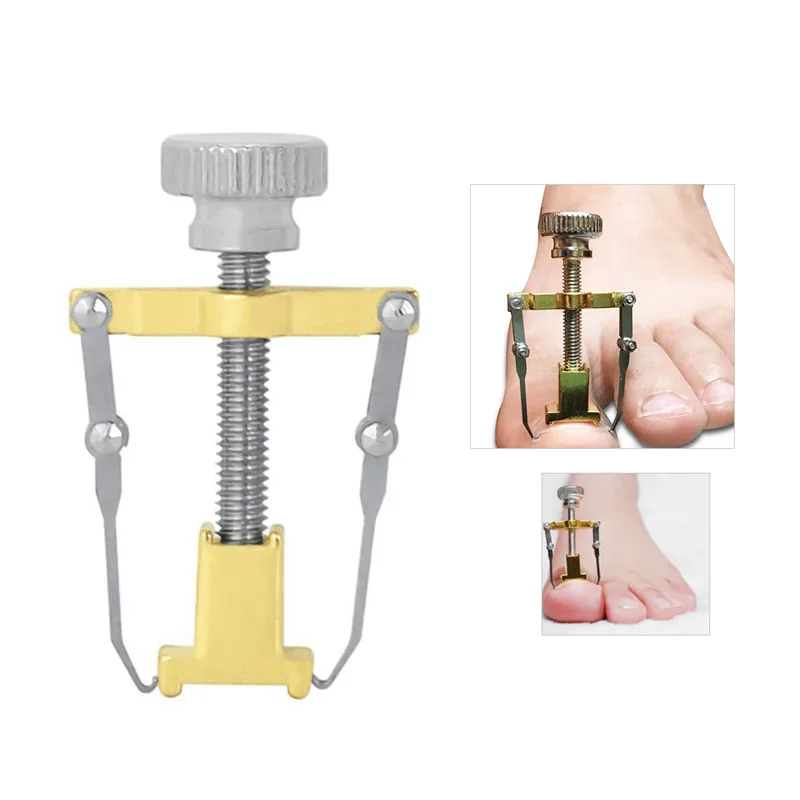 

Ingrown Ingrown Toenail Tool Manicure Pedicure Nails Foot Care Toe Nail Correction Tools Fixer Recover Professional Paronychia32