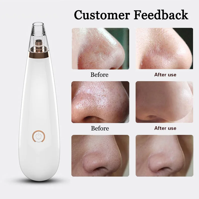 

VIP Dropshipping Blackhead Remover Vacuum Pore Cleaner Electric Nose Face Deep Cleansing Skin Care Machine Tool Black Dot Acne 5