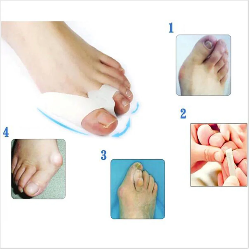 

1 pair Hot Selling Toe Seperating Gel Bunion Shield Gel Toe Separators Bunion Protector Straightener Valgus Corrector Alignment