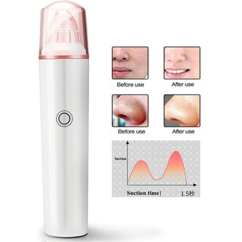 

New 3-Stage Adsorption Vacuum Blackhead Remover Facial Spot Cleaner Acne Removal Instrument Utilizes Pore Carnation Extractor