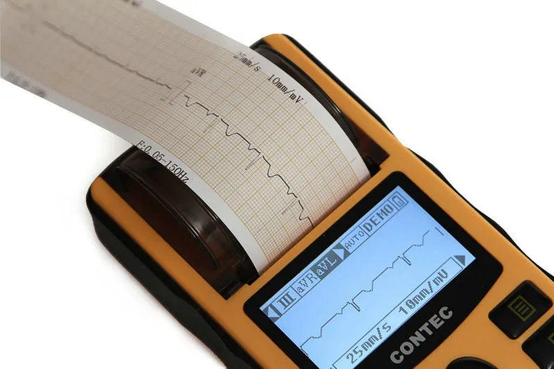 CONTEC CE, портативный цифровой Одноканальный электрокардиограф+ бесплатное программное обеспечение, ECG80A