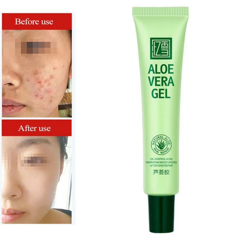 

Aloe Moisturizer Hydrating Remove Acne Shrinking Pores Firming Skin Aloe Vera Gel Long Lasting Natural