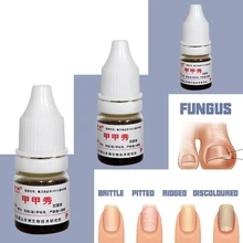 Уход за ногтями для ног эффективное удаление грибков оонихомикоза ремонт поврежденных кутикулы ногтей