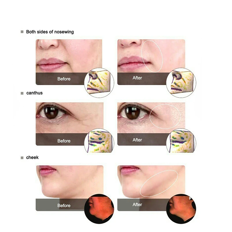 Shopee_9e808a569aff5533860e15d75d0ae8c7