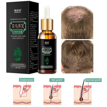 

7days Hair Growth Essential Oils Anti Hair Loss Liquid Dense Hair Growth Serum Essence Hair Loss Product Series