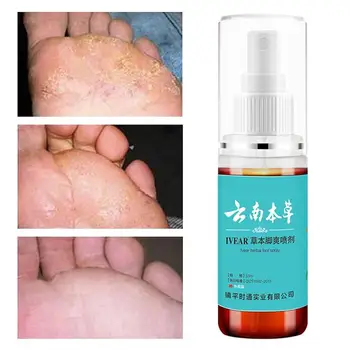 

Mint Athlete's Foot Spray Remover Foot Odor Anti-sweat Antibacterial Bacteriostatic Plant Herb Moisture Anti-fungi Spray