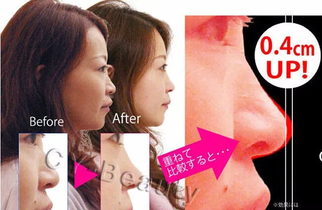 nose up  (1)