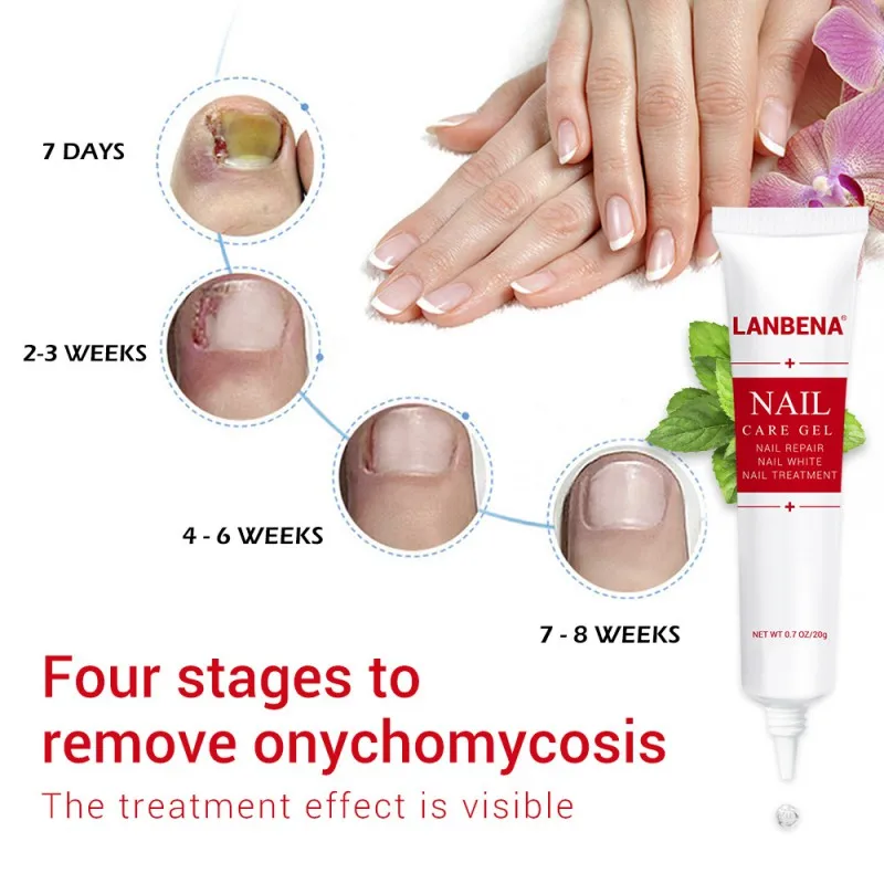 Effective Onychomycosis Paronychia Fungus Infection Repair Solution Gel Fingernails Toenails Care Nail Treatment Pen