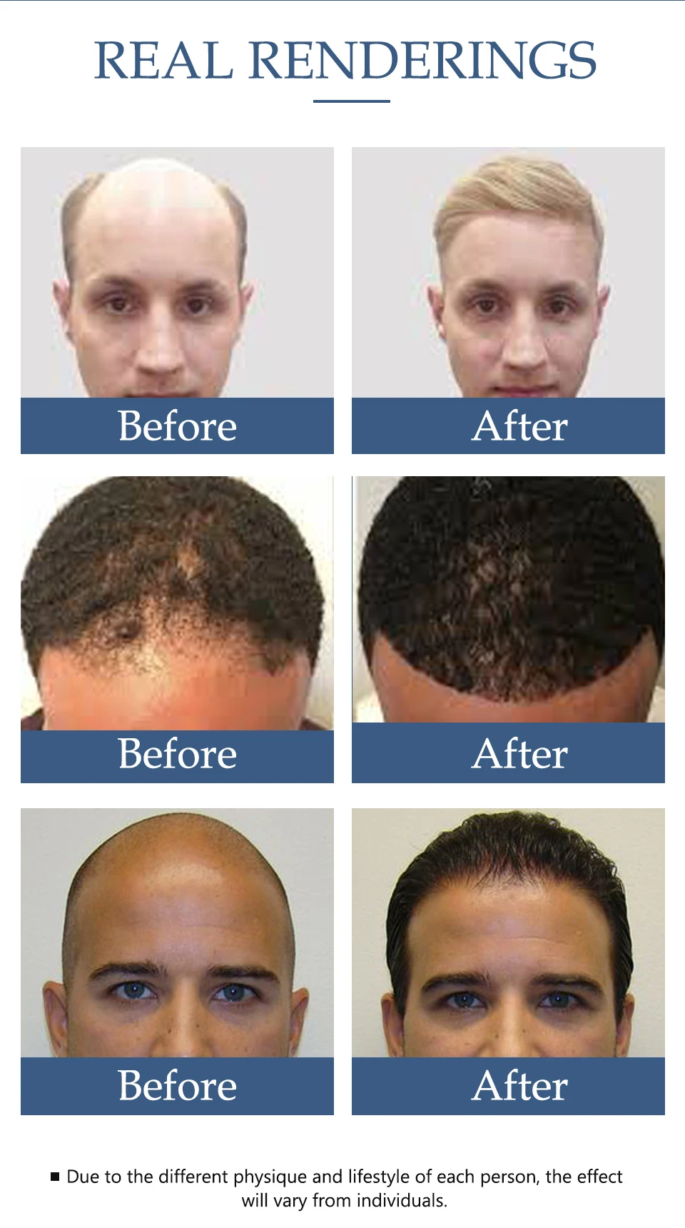 Natural para Crescimento Óleo de Ervas para Controle do Crescimento do Cabelo Tratamento da Queda Cuidados com o Cuidado Óleo Capilar Ajuda no 11 Prod. perda cab. masc.
