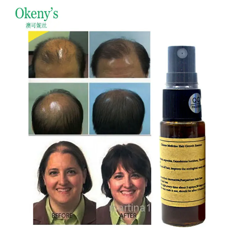 Okeny's Yuda Pilatory EXTRA STRENGTH 7 дней загуститель волос более быстрое лечение роста