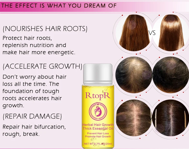 RtopR, новинка, эфирное масло для роста волос, 20 мл, травяное, быстрое, для роста волос, удлиненное, густое, эссенция, профессиональные продукты против выпадения волос
