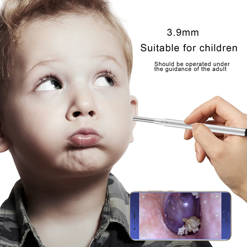 Speedu 3 9 мм HD 720P 3в1 USB медицинский эндоскоп для ушей Otoscope камера Водонепроницаемый OTG