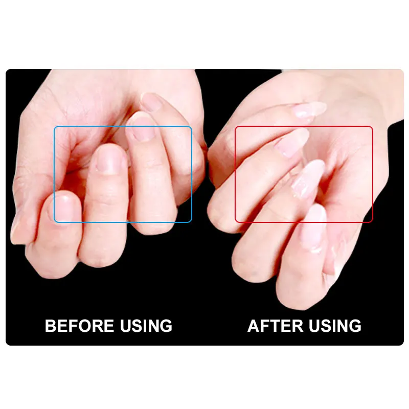 Ellwings 1 قطعة الأشعة فوق البنفسجية هلام لمسمار ملحقات مسمار الفن منشئ أساس لاصق غراء الأكريليك هلام طلاء الأظافر طويلة الأمد Ellwings 1 قطعة الأشعة فوق البنفسجية هلام لمسمار ملحقات مسمار الفن منشئ أساس لاصق غراء الأكريليك هلام طلاء الأظافر طويلة الأمد