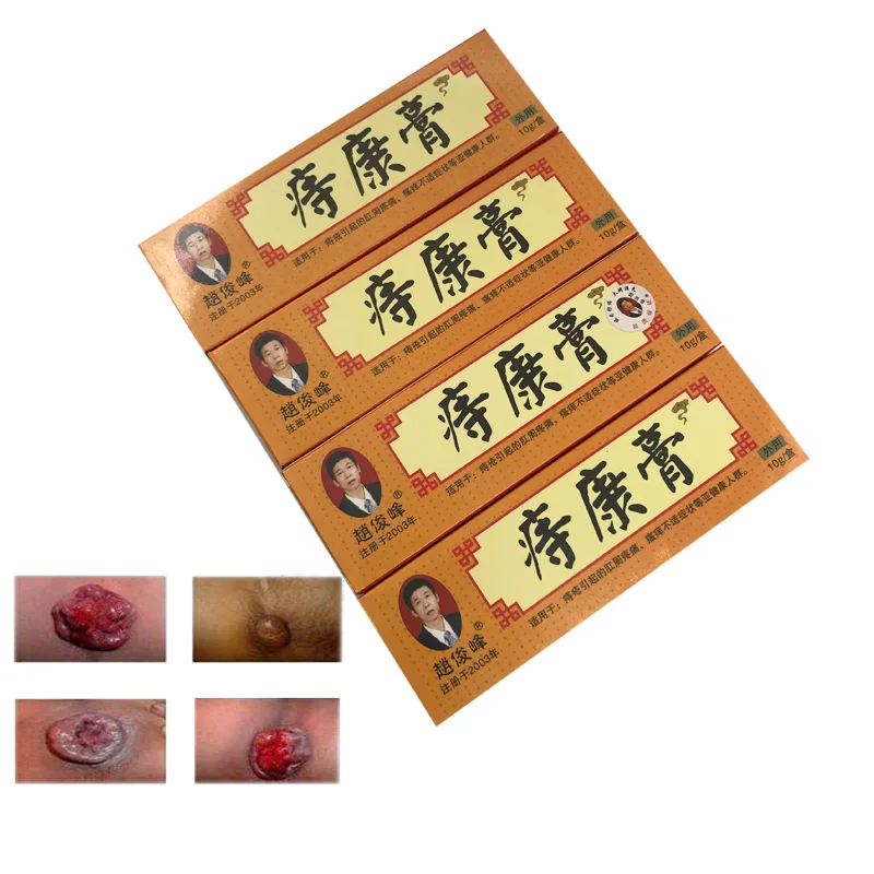 Koop 4 stks Aambeien Zalf Zetpil Krachtige Aambeien Zalf Externe Aambeien, Anale Kloof, Interne, Gemengde Aambeien