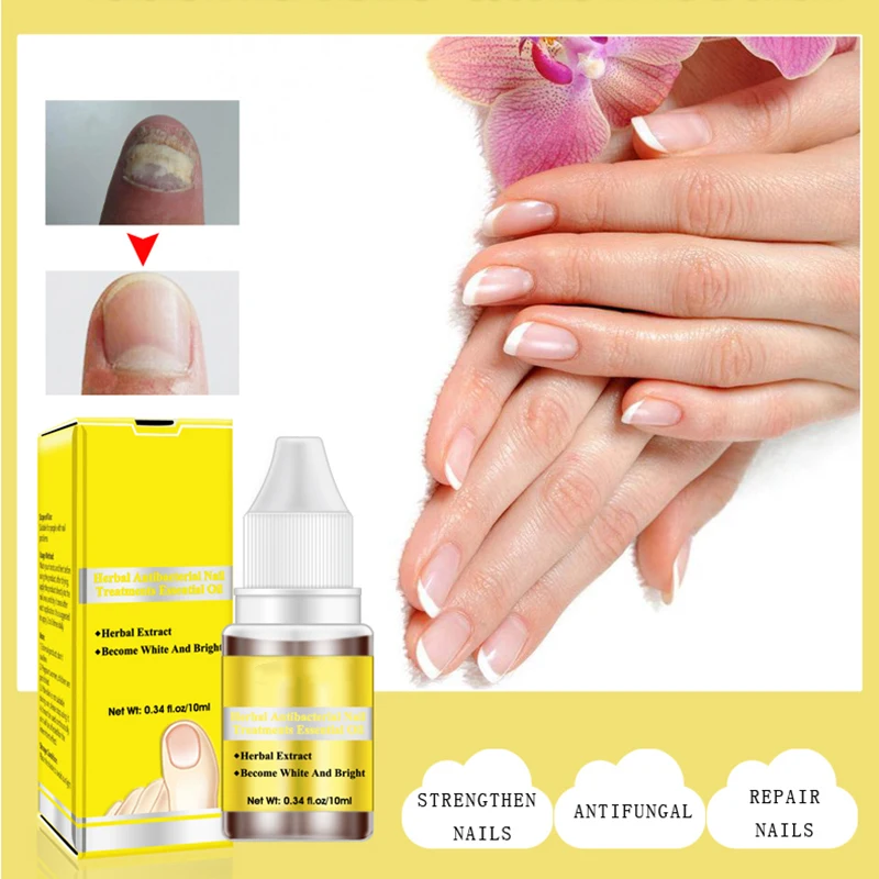 10ML Fungal Nail Treatment oils Nail Whitening Oil Effective Removal