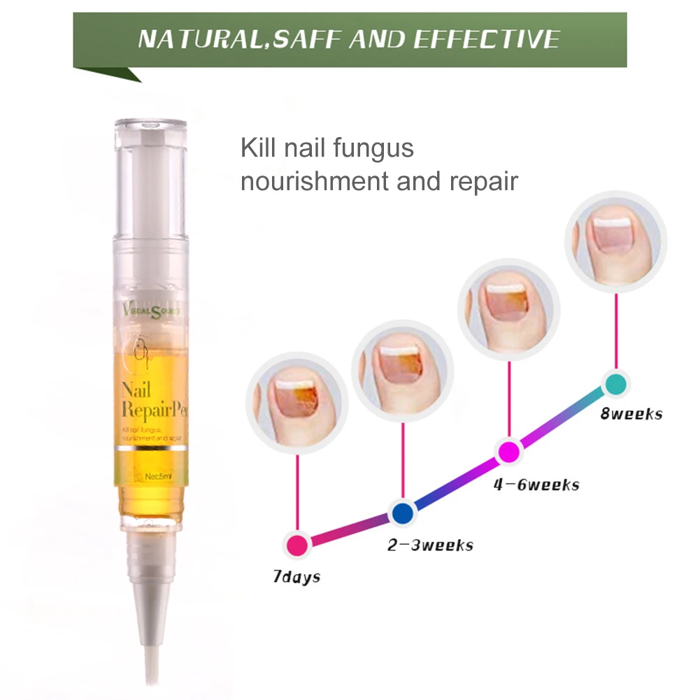 Ручка для лечения грибка для ногтей анти-Лечение ногтей от грибка улучшает неровный сухой гриб стоп гель для ногтей вернуть Блестящий