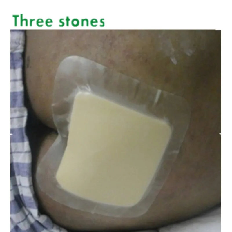 12.5*12.5cm adhesive hydrocolloid wound dressing with foam pad for
