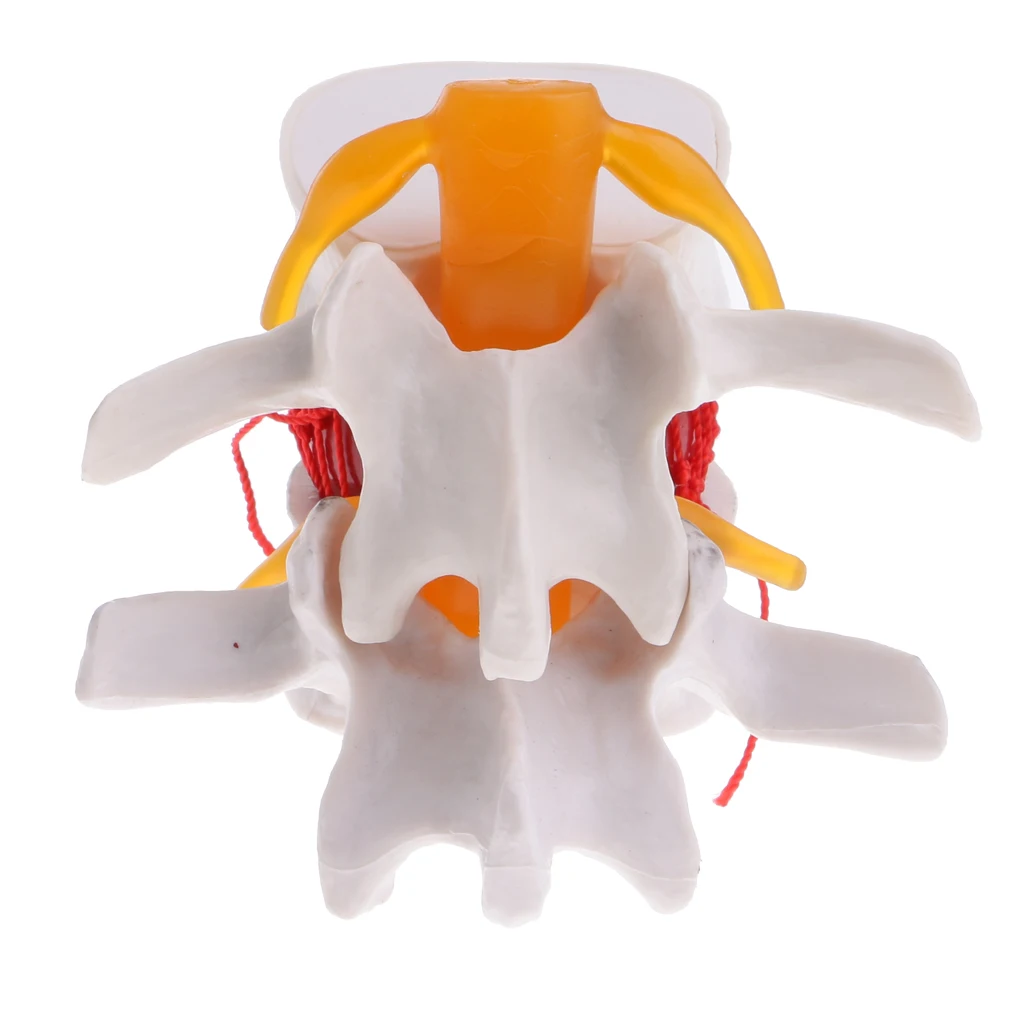 2PCS Magnify 2 Times Human Spine Lumbar Vertebrae Degenerative Disc Skeleton Model Educative Science Toy Lab Study Kits