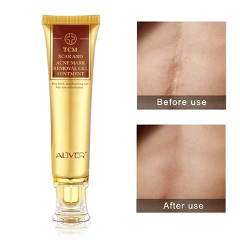 

Face Stretch Marks And Scar Remover Maternity Skin Body Repair Cream Remove Scar Skin Care Cream Face Care dropship support
