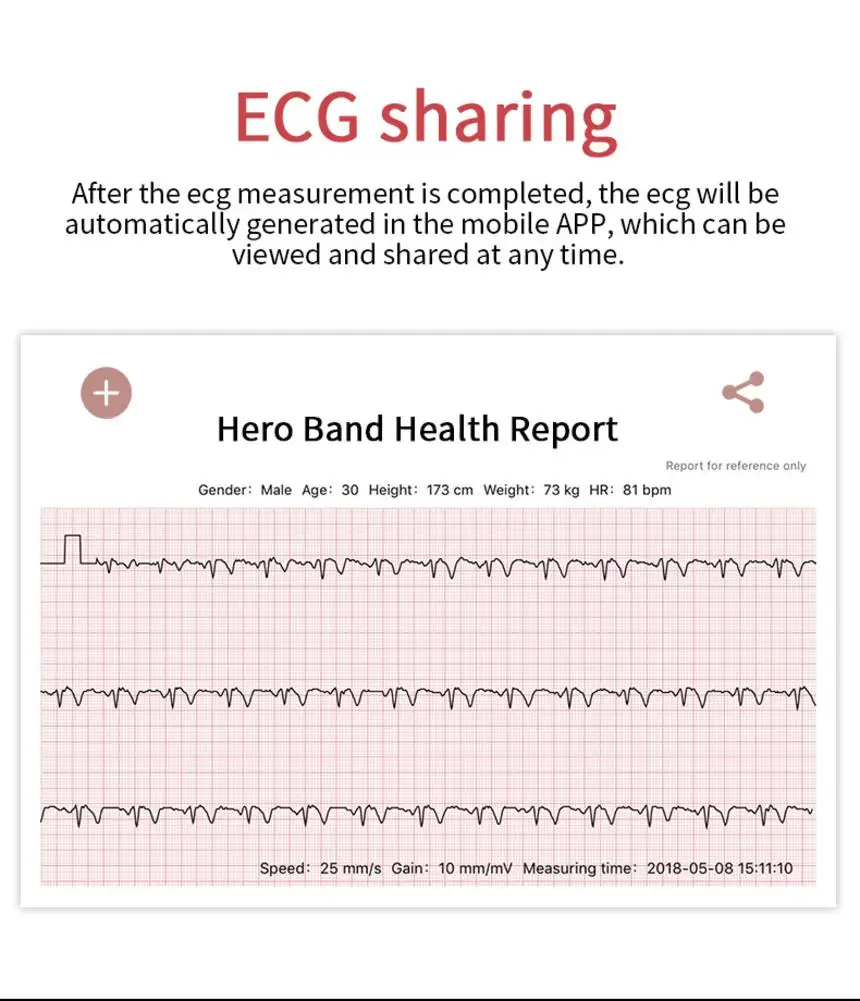Спортивные Bluetooth умные часы для поддержания здорового образа жизни PPG ECG B79 цветной экран умный Браслет Пульс кровяное давление монитор сна напоминание о звонке