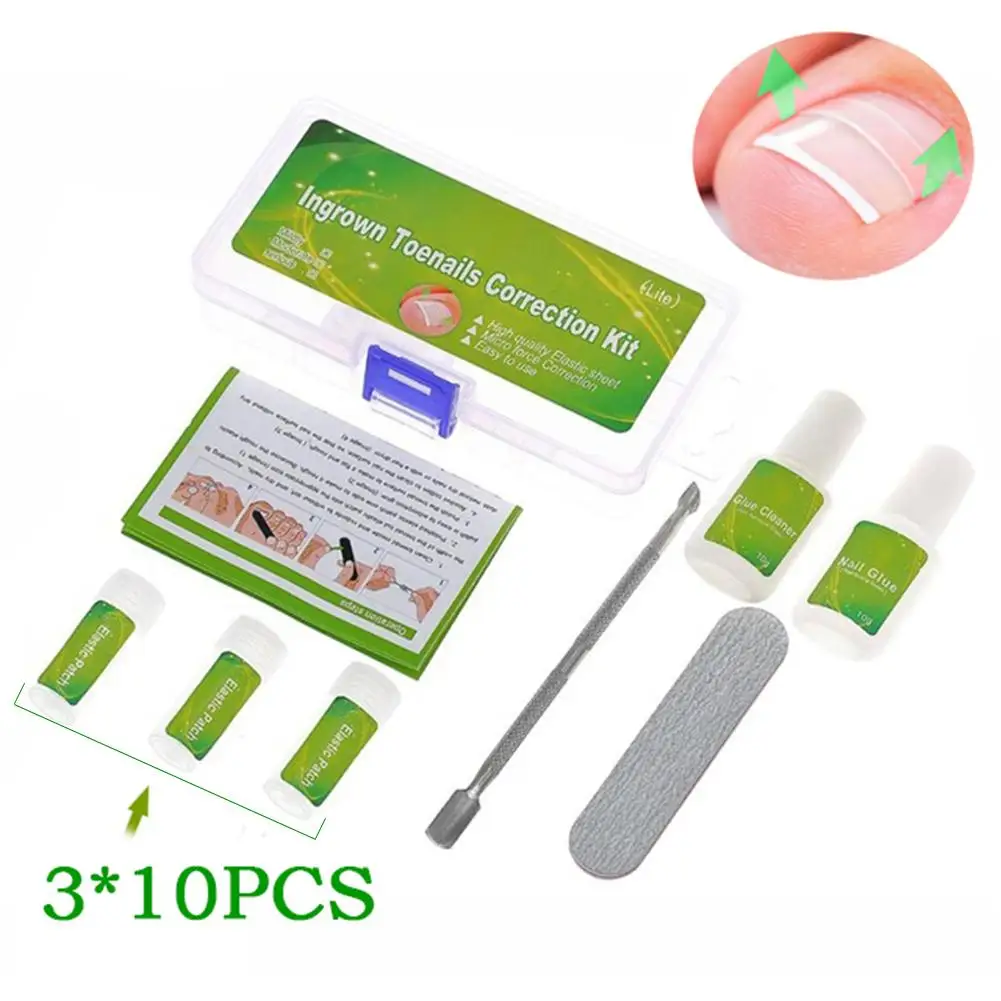 

30pcs patch set Professional Ingrown Toe Nail Correction Pedicure Tools Foot Care Fix Clip Toenail Protector Treatment Kit 3 Sty
