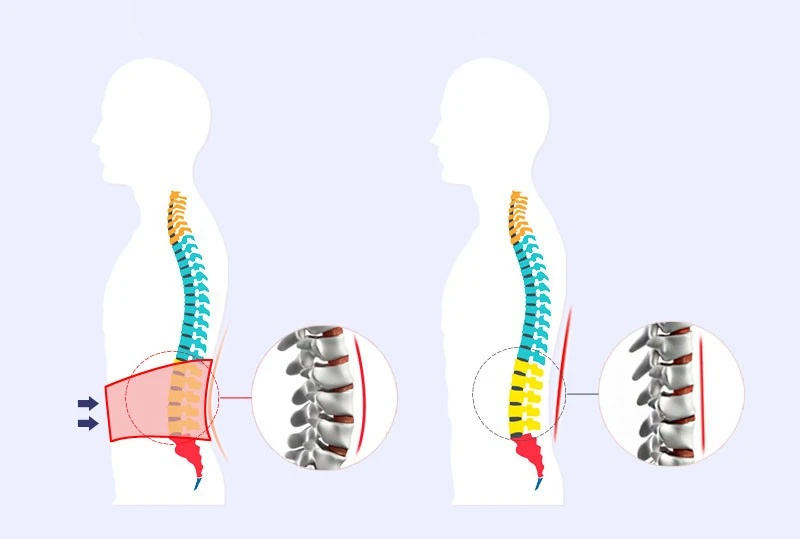 YihCare медицинский Поясничный дисковый грыж массажер для спины пояс спинальная воздушная тяга декомпрессионная скобка боль Нижняя поясничная поддержка